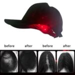 Terapie Laser Impotriva Caderii Parului - imagine 4